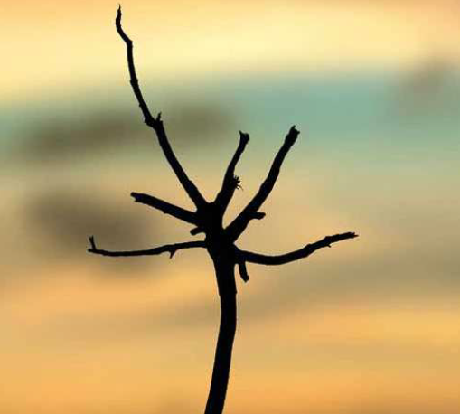 פיברומיאלגיה